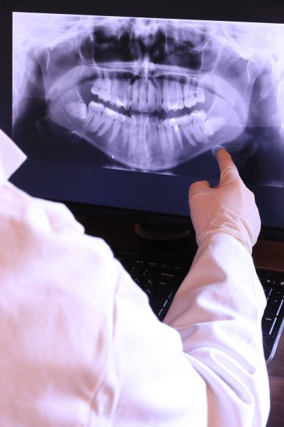 Best Emergency Wisdom Teeth Removal in Harbour Heights, FL