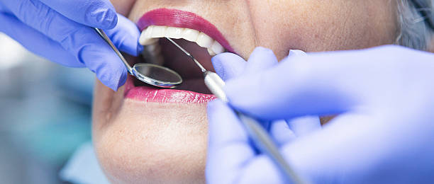 Best Walk-In Emergency Dentist in Harbour Heights, FL
